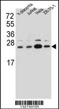 SSR2 Antibody (C-term)