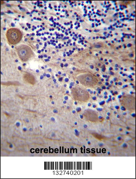 SSR2 Antibody (C-term)