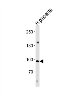 NFATC4 Antibody (C-term)