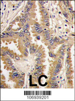 Bad Antibody (Center)