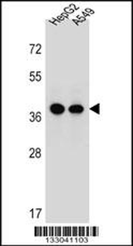 ERLIN1 Antibody (Center)