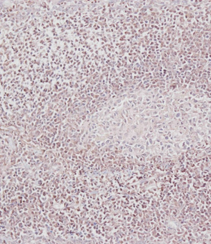 Bcl-2 Antibody (BH3 Domain Specific)