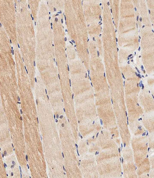 ASAM Antibody (Center)