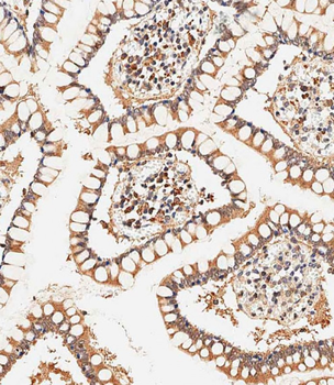 ASAM Antibody (Center)