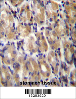 TOR1B Antibody (C-term)