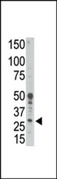 BCL2A1 (A1) Antibody (BH3 Domain Specific)