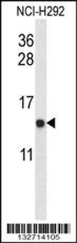 UQCRB Antibody (Center)