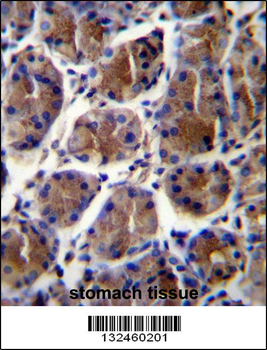 GIF Antibody (Center)