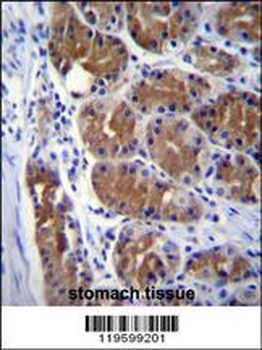 DCTN2 Antibody (Center)