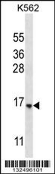 STARD5 Antibody (N-term)