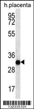 COPS7A Antibody (C-term)