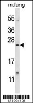 XBP1 Antibody (C-term)
