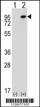 WHSC1L1 Antibody (N-term)