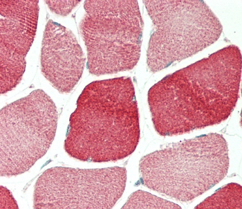 TPM4 Antibody (N-term)