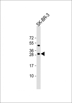 CSN2 Antibody (N-term)