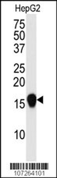 SUMO4 Antibody (V55 Mutant)