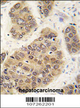 SUMO4 Antibody (M55 Wild type)