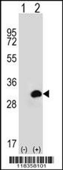 CA1 Antibody (N-term)