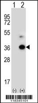 ANGPTL7 Antibody (C-term)