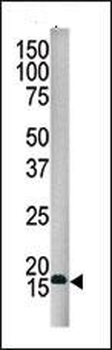 SUMO4 Antibody (Center)