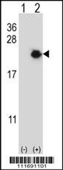 EIF4EBP1 Antibody (Center)