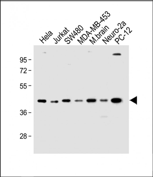 HTR4 Antibody (N-term)