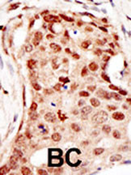 CBLC Antibody (C-term)