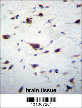 PREX1 Antibody (C-term)