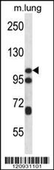 CTNND2 Antibody (C-term)