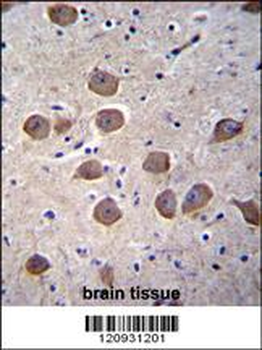 CTNND2 Antibody (C-term)
