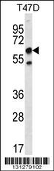 SCP2 Antibody (N-term)