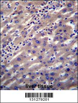 SCP2 Antibody (N-term)