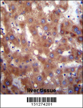 HSD17B4 Antibody (Center)