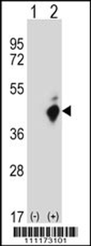 FAS Antibody (C-term Y291)