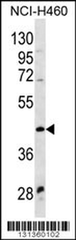 WNT9A Antibody (Center)