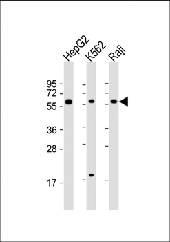 TGFB1 Antibody (N-term)