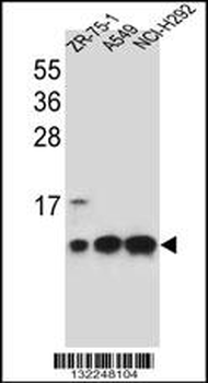 COX6B1 Antibody (C-term)