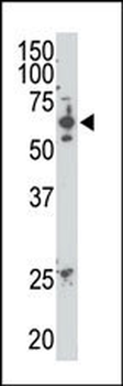 SENP2 Antibody (C-term)
