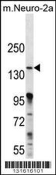 MAP3K15 Antibody (N-term)