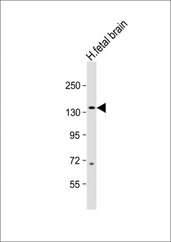 MAP3K15 Antibody (N-term)