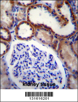 MAP3K15 Antibody (N-term)