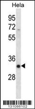 SFRS7 Antibody (N-term)