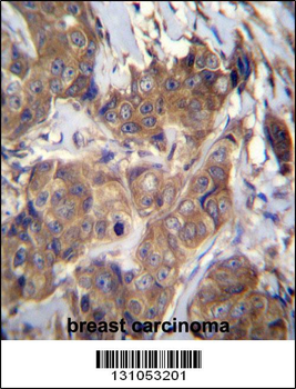 ATP6V1B1 Antibody (C-term)