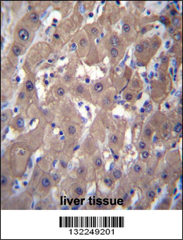 AKR1C2 Antibody (C-term)