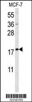 SUMO1 Antibody