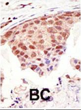 SUMO1 Antibody (C-term)
