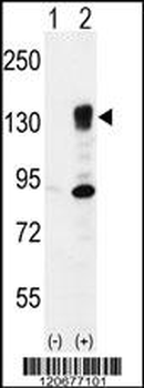 ITGA5 Antibody (Center)