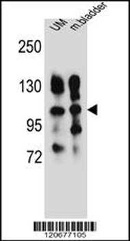 ITGA5 Antibody (Center)