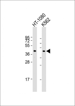 PCYT1A Antibody (N-term)