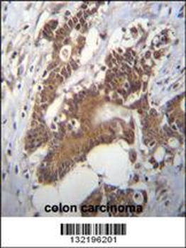 PCYT1A Antibody (N-term)